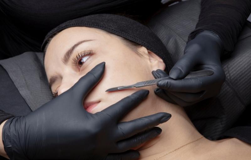 Dermaplaning face acne treatments