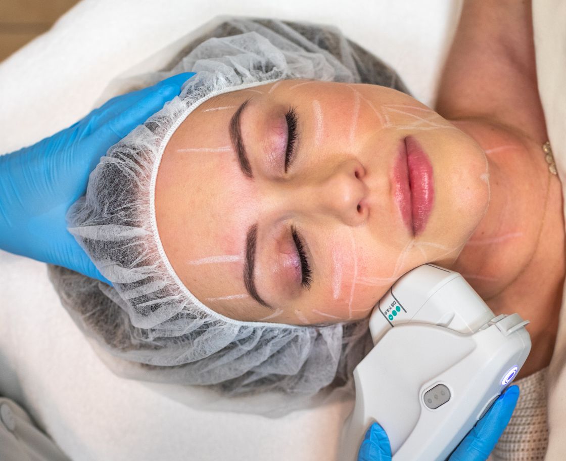 Ultherapy woman