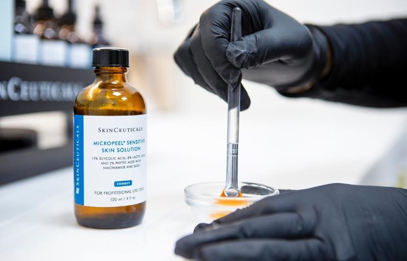chemical peel product acne treatments